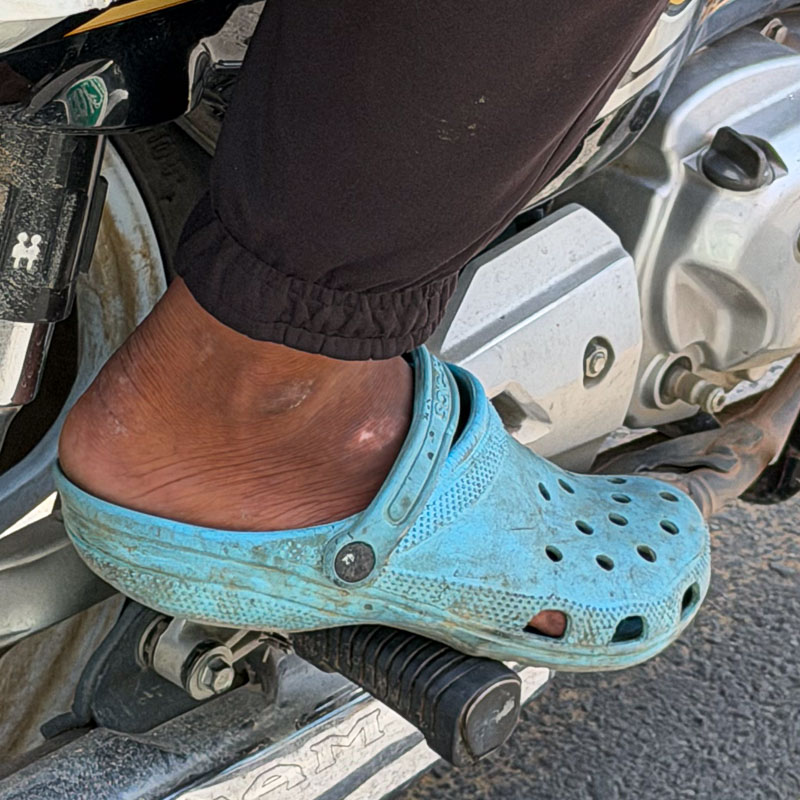 Crocs